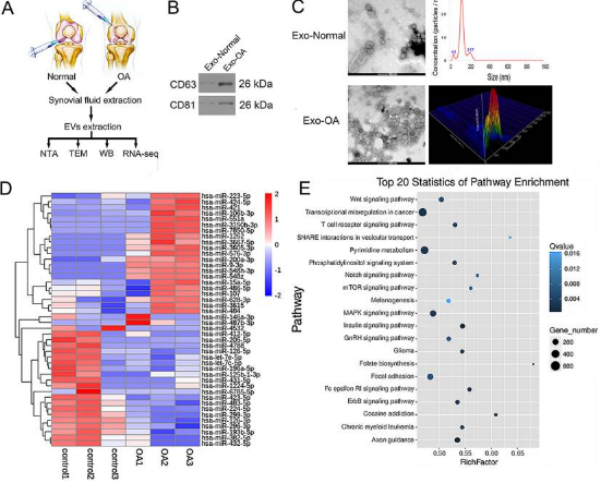 过表达miR-126-3p的滑膜成纤维细胞来源的外泌体在骨关节炎大鼠模型中抑制软骨细胞炎症和软骨降解