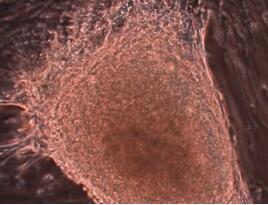 大鼠、小鼠心脏干细胞（祖细胞）分离培养方法