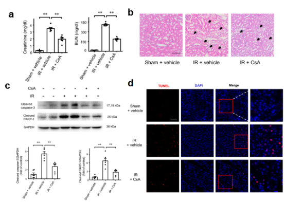 急性肾损伤发病机制