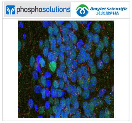 艾美捷Phosphosolutions抗腺苷酸环化酶III抗体方案 艾美捷Phosphosolutions抗腺苷酸环化酶III抗体方案