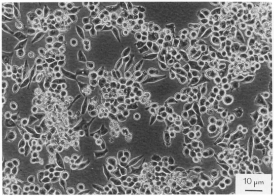 细胞学堂|MKN-45细胞培养知识总结