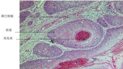 高品质病理限定！爱必信HE染色试剂盒