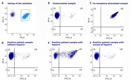 IQ Products肝素诱导血小板减少症检测试剂盒的诊断和结果