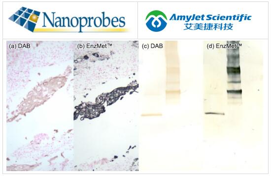 Nanoprobes丨EnzMet 用于免疫组织化学 (IHC) 和印迹 Nanoprobes丨EnzMet 用于免疫组织化学 (IHC) 和印迹