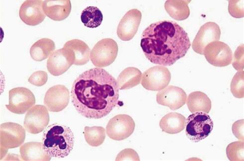 中性粒细胞在稳态和炎症状态下成熟分化和命运决定过程中的异质性群体和转录组动态变化