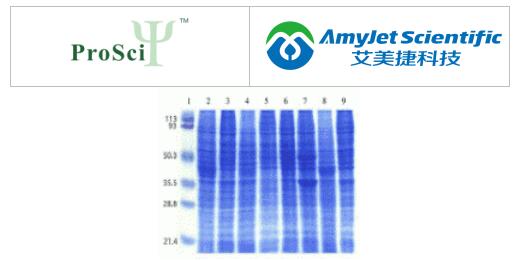 ProSci人细胞系 I 印迹丨人类免疫研究 ProSci人细胞系 I 印迹丨人类免疫研究