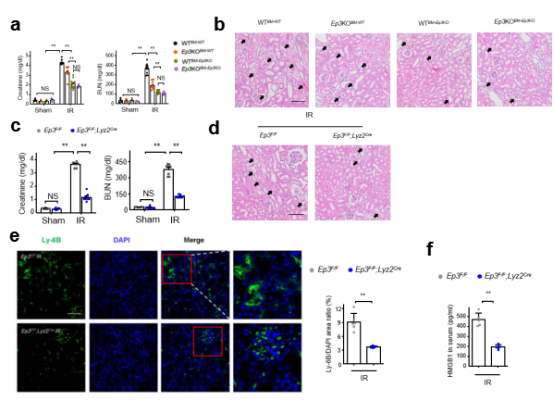 急性肾损伤发病机制