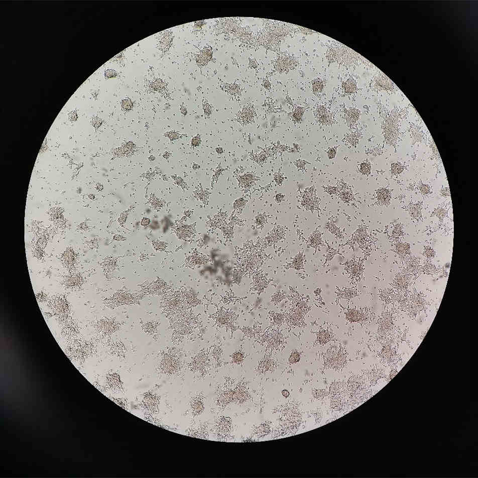 1637547877359219.jpg 成团较严重的SH-SY5Y细胞