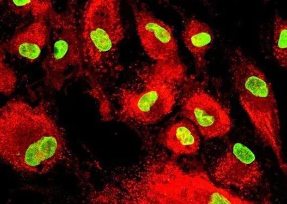 三抗一修”间充质干细胞