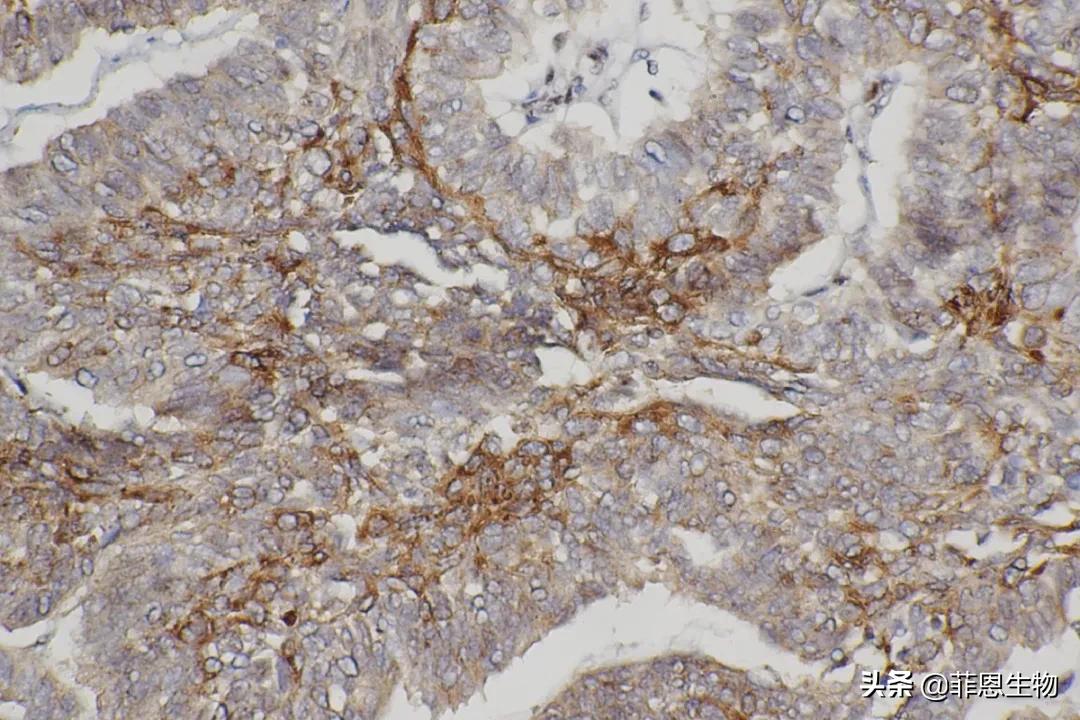 「技术分享」免疫组化基础（1）—如何标准化新免疫组化法