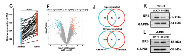 ERβ/circAHNAK轴抑制USP10-FMR1去泛素化，从而阻止m6A介导的ADAM17降解并促进透明细胞肾癌血管生成