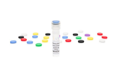 研究文献丨艾美捷抗人IL-8 (CXCL8)单抗MT8F19介绍