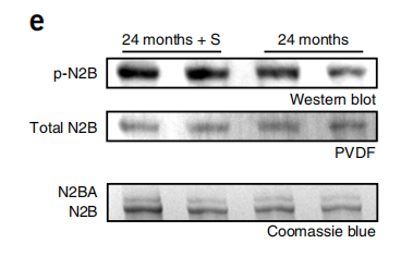 ECM Biosciences丨艾美捷磷酸化丝氨酸抗体方案