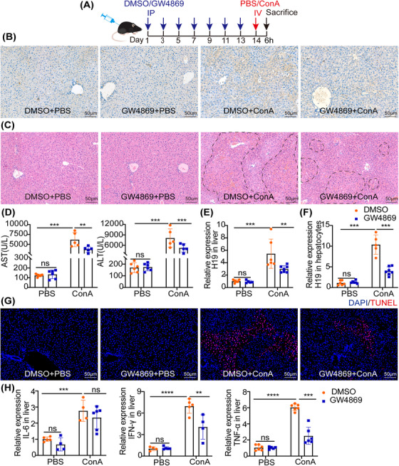 【MedComm】 9.9分，M1巨噬细胞来源外泌体通过向肝细胞转移LncRNA H19促进自身免疫性肝损伤
