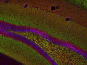 IHC：VGluT1(1:500; 绿) 