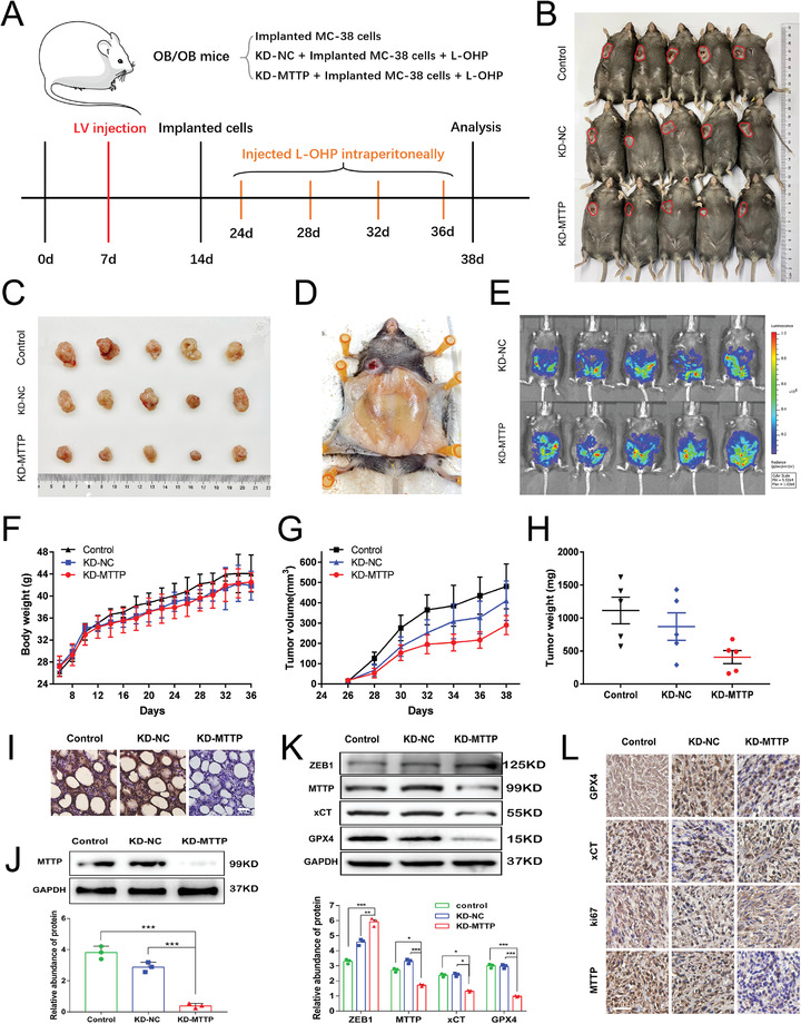 铁死亡 外泌体.jpg