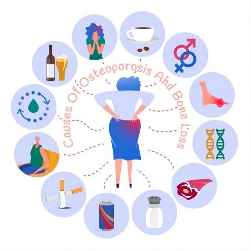 疾病模型专辑｜骨质疏松症