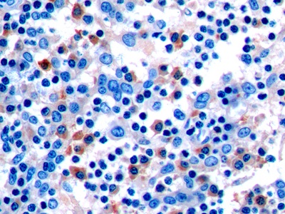Necroptosis通路为生殖系统器官程序性衰老的生化程序