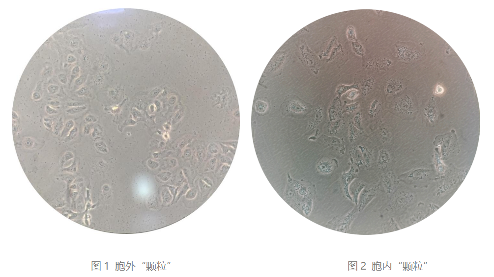 细胞培养背景有“颗粒”？全面解析！