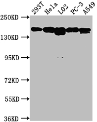 Epigentek-MET重组单克隆抗体[2D12]-性价比超高的好物！