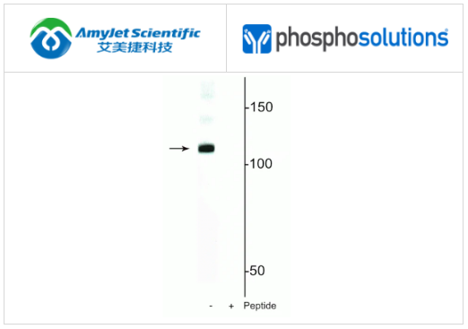 PhosphoSolutions抗DGCR8(Ser377)抗体解决方案 PhosphoSolutions抗DGCR8(Ser377)抗体解决方案