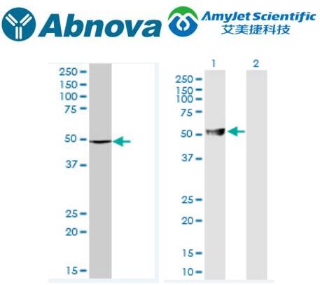 Abnova ABAT 纯化 MaxPab 小鼠多克隆抗体说明书 Abnova ABAT 纯化 MaxPab 小鼠多克隆抗体说明书