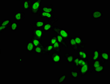 Epigentek-组蛋白H3.1K36me1单克隆抗体[RMC418G]，超值优惠不容错过！