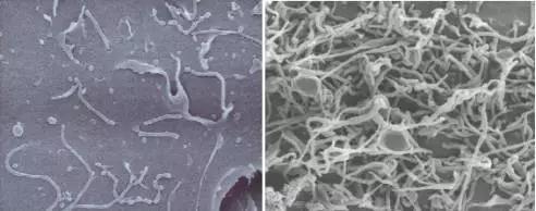 细胞培养之支原体检测方法~支原体检测培养法