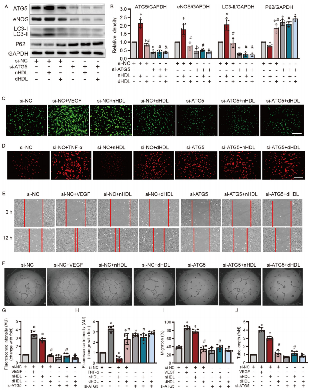 文献解读 | 高密度脂蛋白通过miR-181a-5p调控自噬影响血管新生