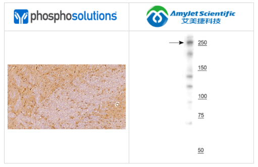 PhosphoSolutions抗NG2/CSPG4抗体解决方案