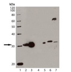 血红素加氧酶-1(HO-1) 单克隆抗体,助力科学研究 血红素加氧酶-1(HO-1) 单克隆抗体,助力科学研究