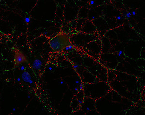ICC：VGluT1(1:1000; 红)