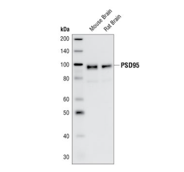 PSD95抗体研究丨SYSY PSD95抗体结果图展示
