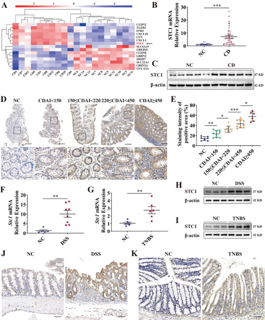 LabEX多因子检测助力炎症性肠病研究，揭示STC1通过JNK激活促进细胞死亡
