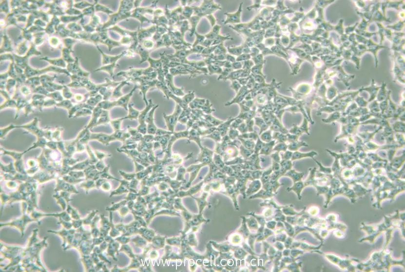 细胞学堂 | 脱落的293T细胞如何恢复正常