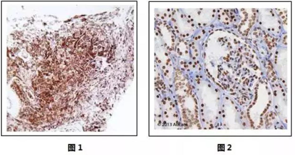 免疫组化:非特异性染色的八大原因