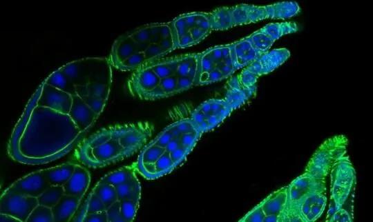 细胞的代谢重编程会促进雌性摄入更多的糖分