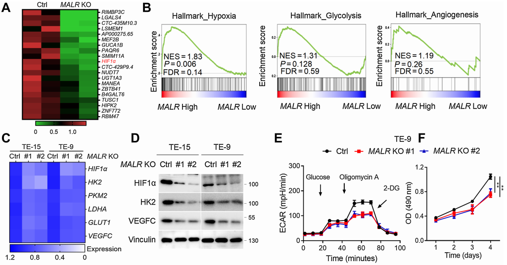 【客户文献解读,IF>11】食管癌的
