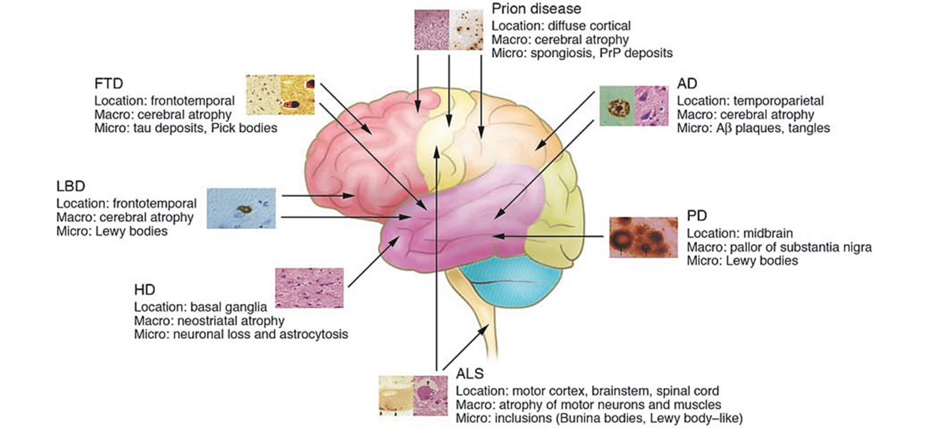 国自然热点│天然产物调控线粒体自噬在预防神经退行性疾病中的应用