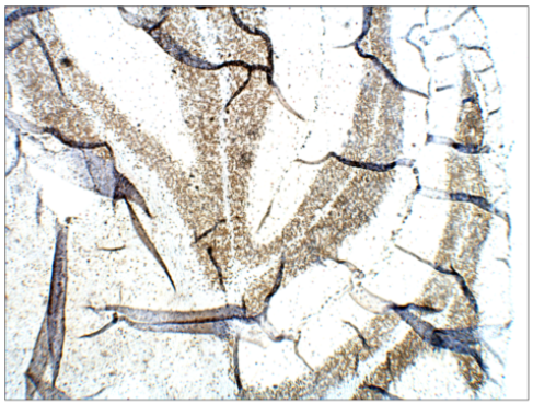 FabGennix-食欲素A抗体促销中 FabGennix-食欲素A抗体促销中