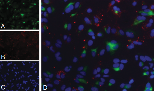 艾美捷细胞低密度脂肪酸(LDL)摄取试剂盒的功能&应用 艾美捷细胞低密度脂肪酸(LDL)摄取试剂盒的功能&应用
