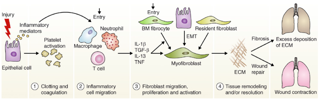 你为什么还不会做肺纤维化？