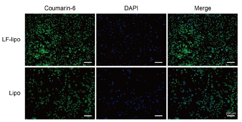 脂质体在炎性肠病中的应用