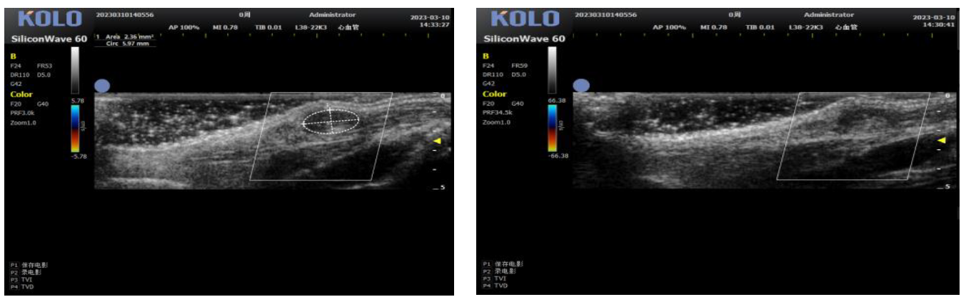 小动物成像检测有哪些?可以对应哪些指标?
