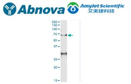 Abnova ACD（人）IP-WB 抗体对 质量控制测试说明