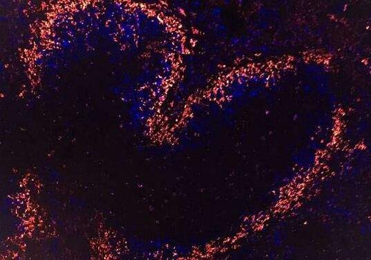 科学家在细胞中发现一种能促进抗体大量产生的特殊蛋白