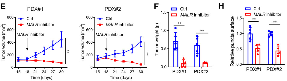 【客户文献解读,IF>11】食管癌的
