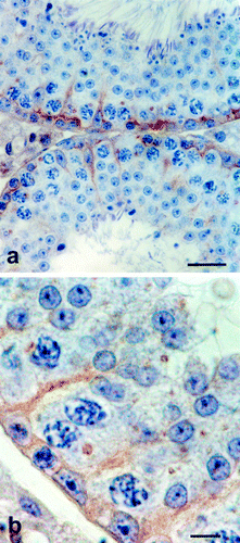 艾美捷Claudin-11抗体解决方案