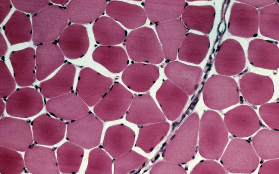 成体骨骼肌细胞的培养方法及注意事项