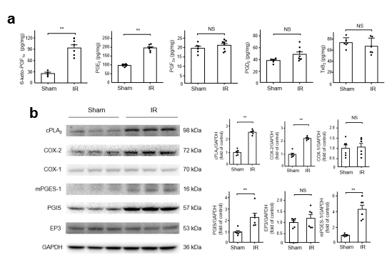 急性肾损伤发病机制